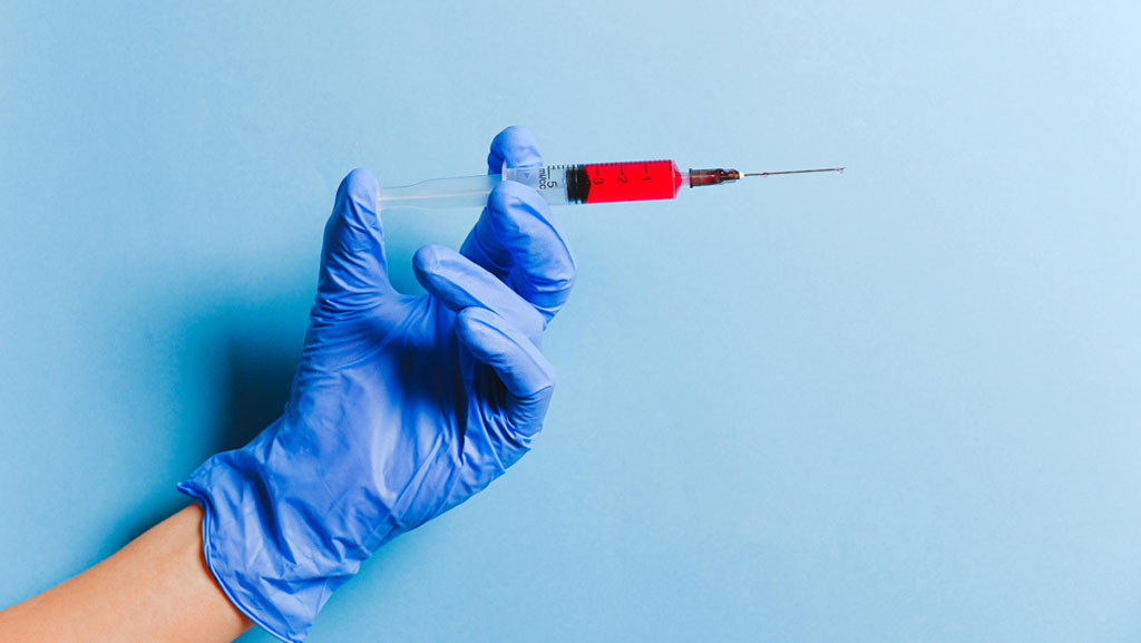 Testing blood for CBD levels to determine how long CBD stays in your system