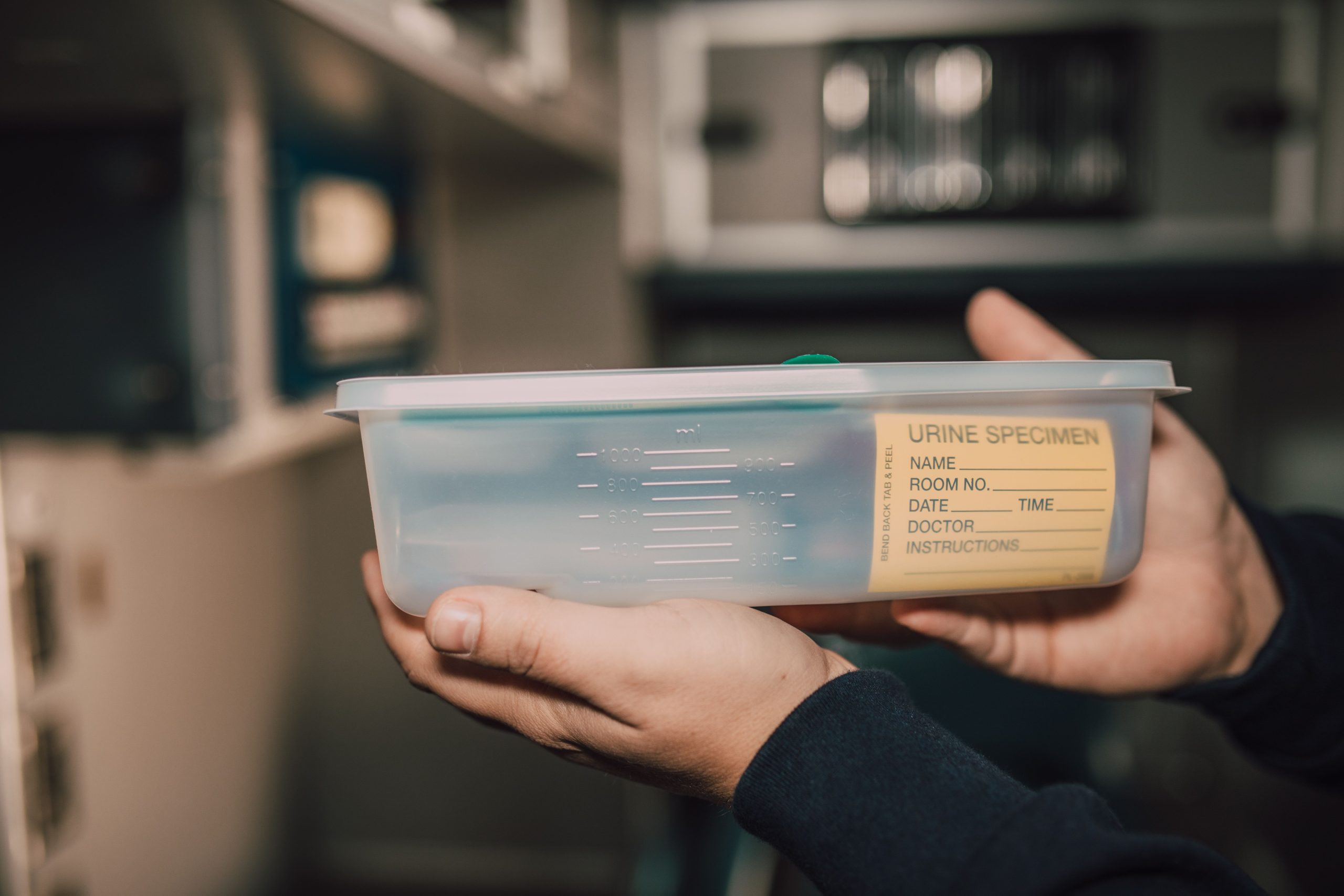 Person holding a urine test used to detect THC and cannabis metabolites